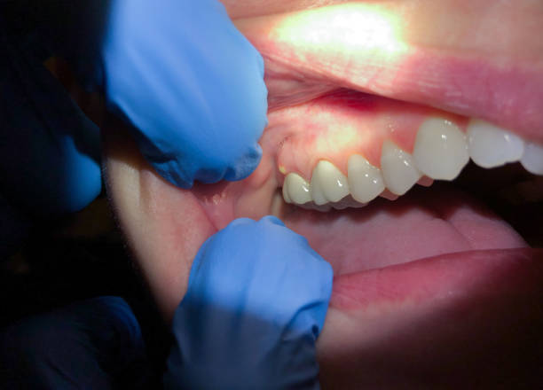 Best Tooth Pain Emergency Relief  in Crownsville, MD