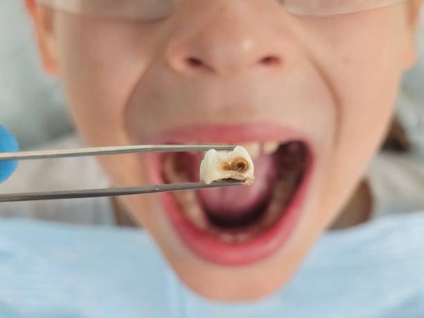 Best Knocked-Out Tooth Emergency  in Crownsville, MD